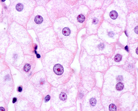 Liver cells (hepatocytes) seen with the light microscope. Their nuclei show a very large nucleolus stained in red.