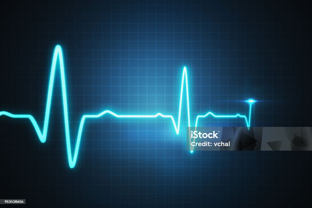 EKG - cardiogram para monitorar o batimento cardíaco. 3D renderizados ilustração. - Foto de stock de Ritmo Cardíaco royalty-free