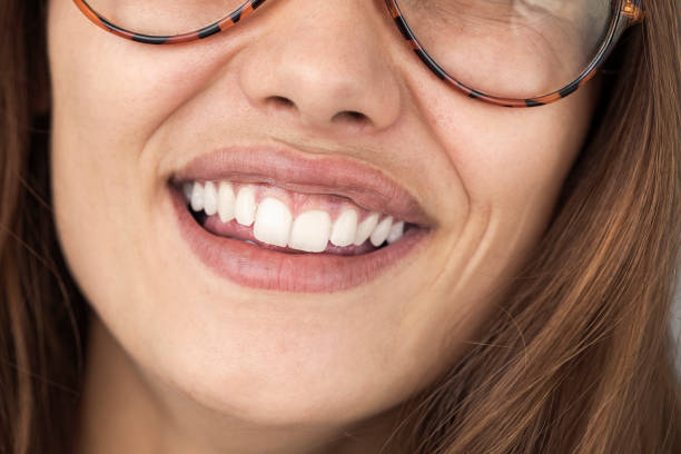 istock Closeup of smile with white healthy teeth 953452442