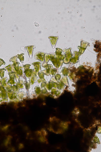 istock Vorticella (organism) in waste water under the microscope. 953511120