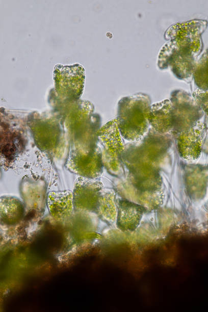 istock Vorticella (organism) in waste water under the microscope. 953511126