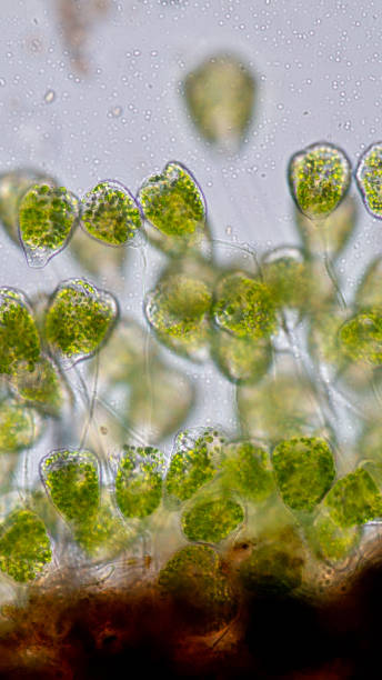 istock Vorticella (organism) in waste water under the microscope. 953511148