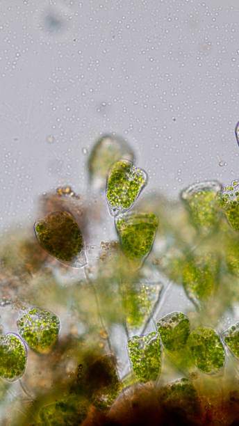 istock Vorticella (organism) in waste water under the microscope. 953511166
