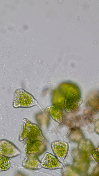 istock Vorticella (organism) in waste water under the microscope. 953511176