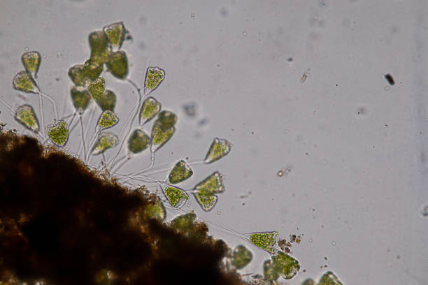 istock Vorticella (organism) in waste water under the microscope. 953511180