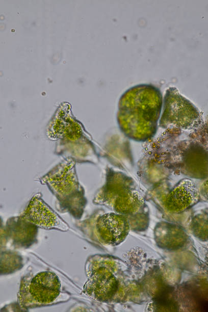 istock Vorticella (organism) in waste water under the microscope. 953511226