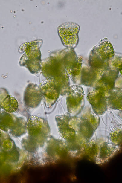 istock Vorticella (organism) in waste water under the microscope. 953511234