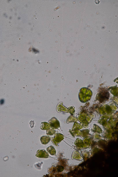 istock Vorticella (organism) in waste water under the microscope. 953511236