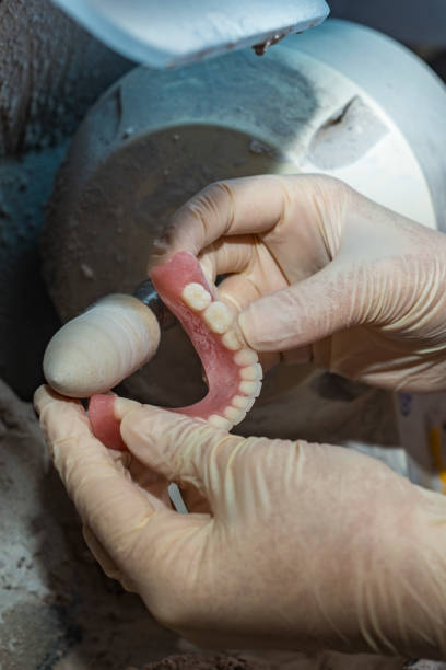istock Dental technician working on dental prosthetic for to polish up 953793154