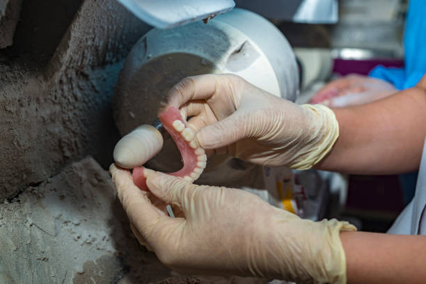 istock Dental technician working on dental prosthetic for to polish up 953793464