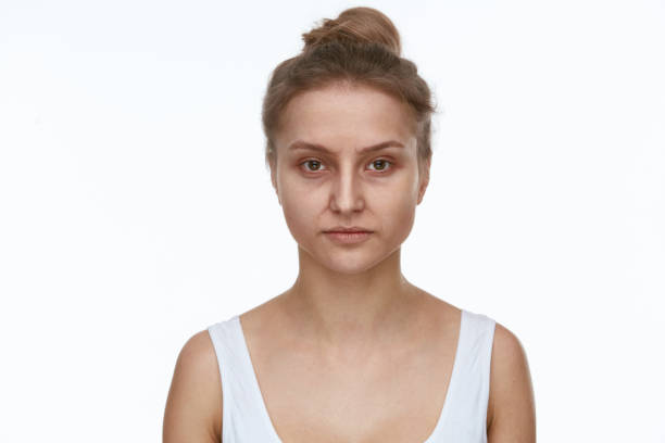 istock Tired Old Woman With Wrinkles And Dark Circles 953830126