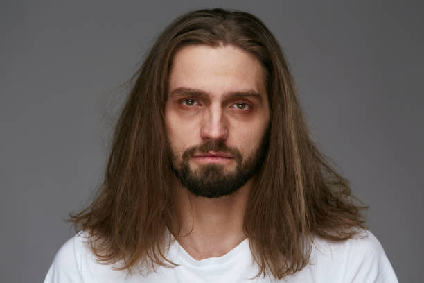 istock Tired Man With Exhausted Face And Dark Circles Under Eyes 953830458