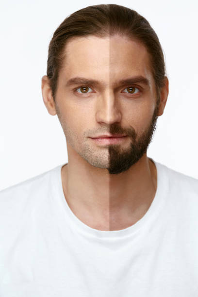 istock Young Man WIth Beard Before And After Shaving 953833926