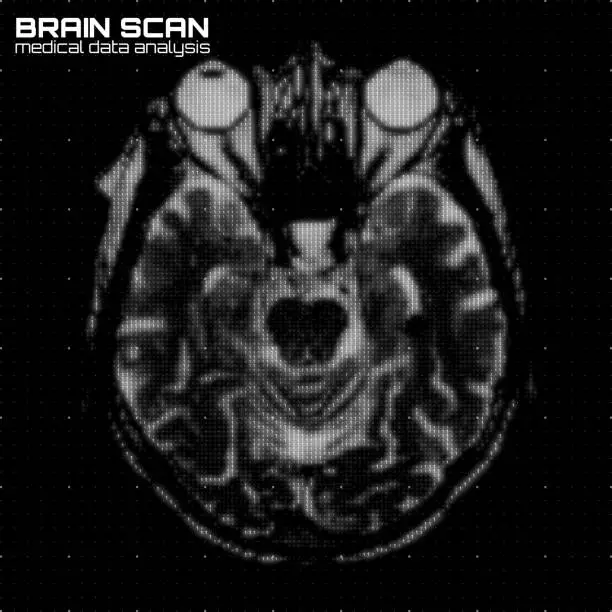 Vector illustration of Vector grayscale abstract brain tomography analysis illustration. Digital brain x-ray scan. Medical data MRI visualization concept. Futuristic healthcare software HUD UI. Data driven image. Human head