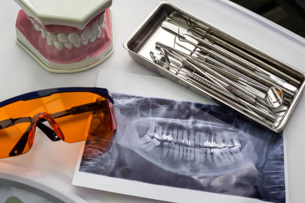 vue de dessus des outils dentaires sur fond blanc.  stomatologie - dentist mirror orthodontist carver photos et images de collection