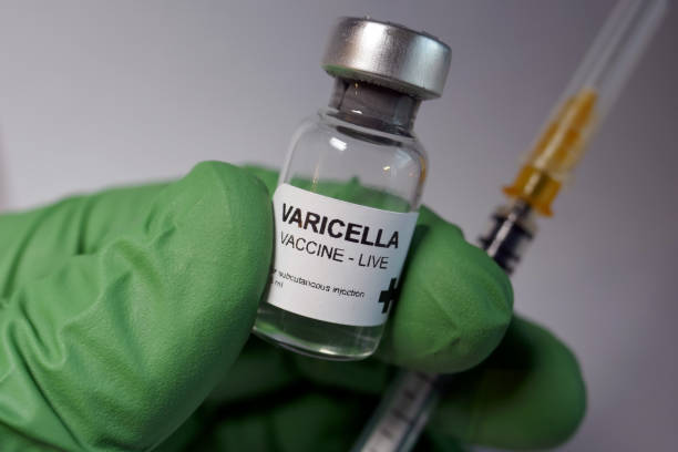 수 두 대상 포진 바이러스 백신 - contageous 뉴스 사진 이미지
