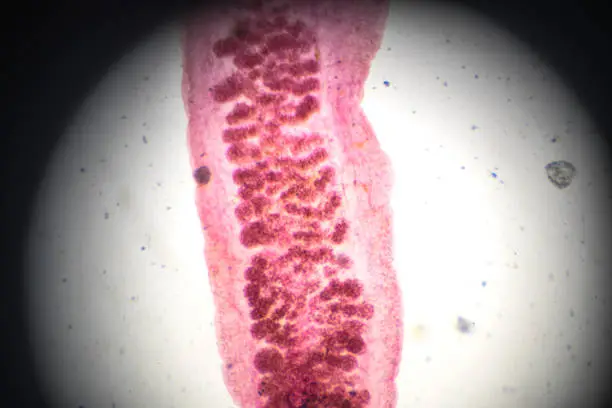 Photo of liver fluke under light microscopy