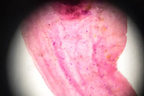 Photo of liver fluke under light microscopy