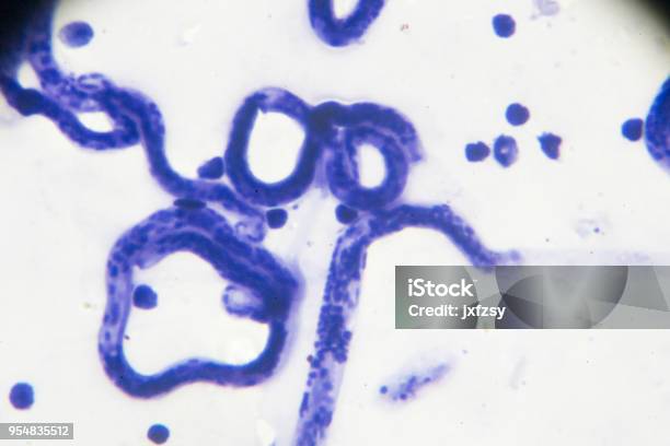 Microlaria Microscope Microfilaria Malayi Under Light Microscopy Stock Photo - Download Image ...