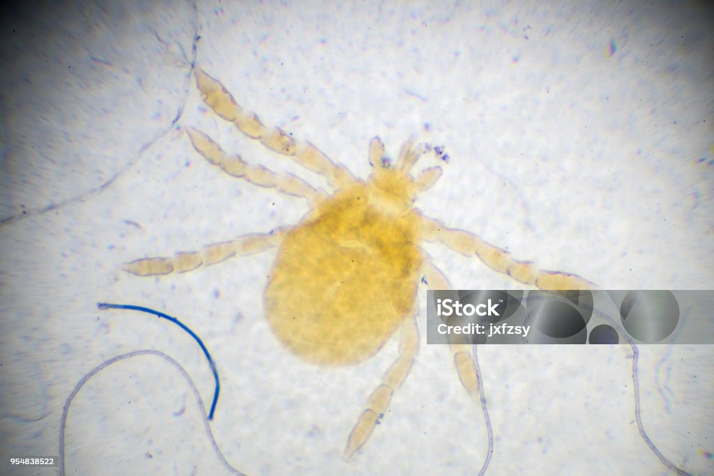 Light Microscope Mite Mite Under Light Microscopy Stock Photo - Download Image Now - Animal ...