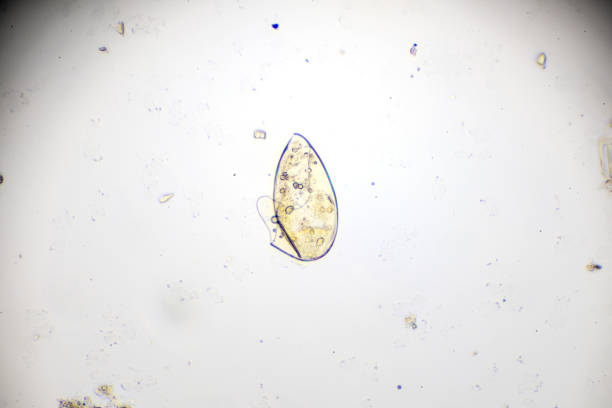 istock ova of fasciolopsis under light microscopy 954843736
