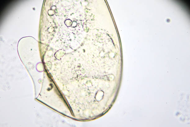 istock ova of fasciolopsis under light microscopy 954843776