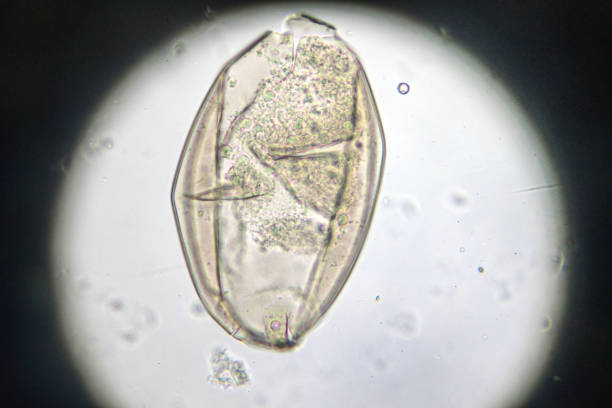 istock ova of fasciolopsis under light microscopy 954844106