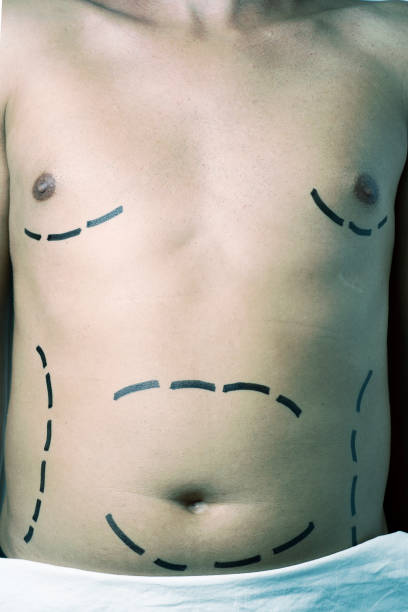 整形手術や脂肪吸引を持っている人 - men muscular build abdominal muscle large ストックフォトと画像
