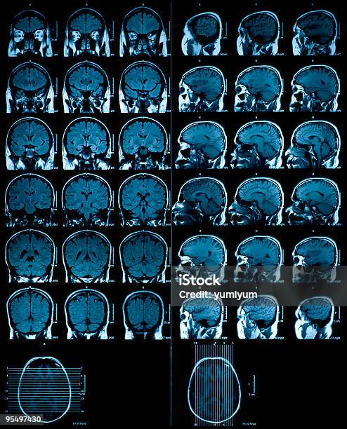 Mri Scan Des Gehirns Stockfoto und mehr Bilder von Anatomie - Anatomie, Daten, Farbbild