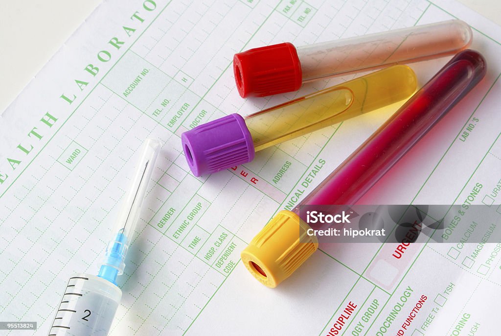 Medical specimens  Liquid Stock Photo