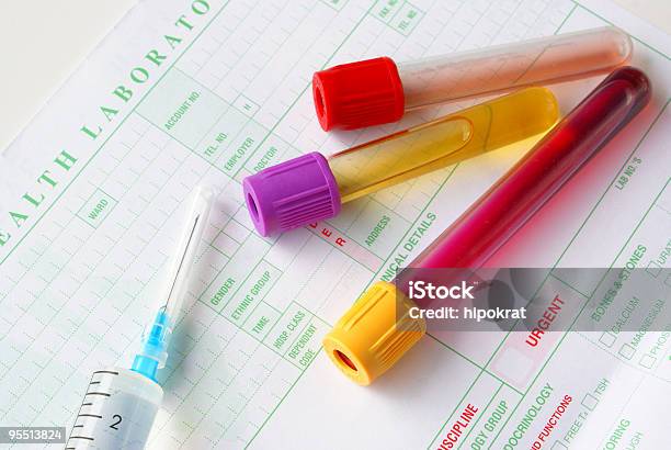 Medical Specimens Stock Photo - Download Image Now - Liquid, Urine Sample, Drug Test