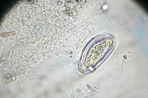 pinworm; oxyurid; seatworm; threadworm egg under light microscopy