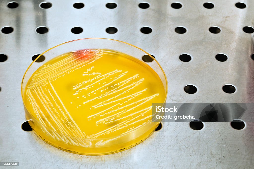 Placa de Petri con bacterias - Foto de stock de Acero libre de derechos