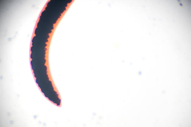 istock Schistosoma japonicum under light microscopy 955251976
