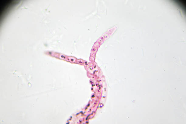 istock schistosoma japonicum cercariae under light microscopy 955256128