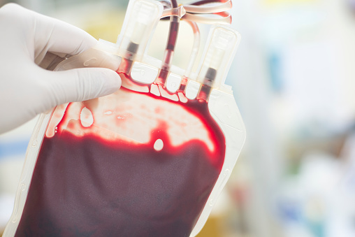 close up blood bag in laboratory medical concept.