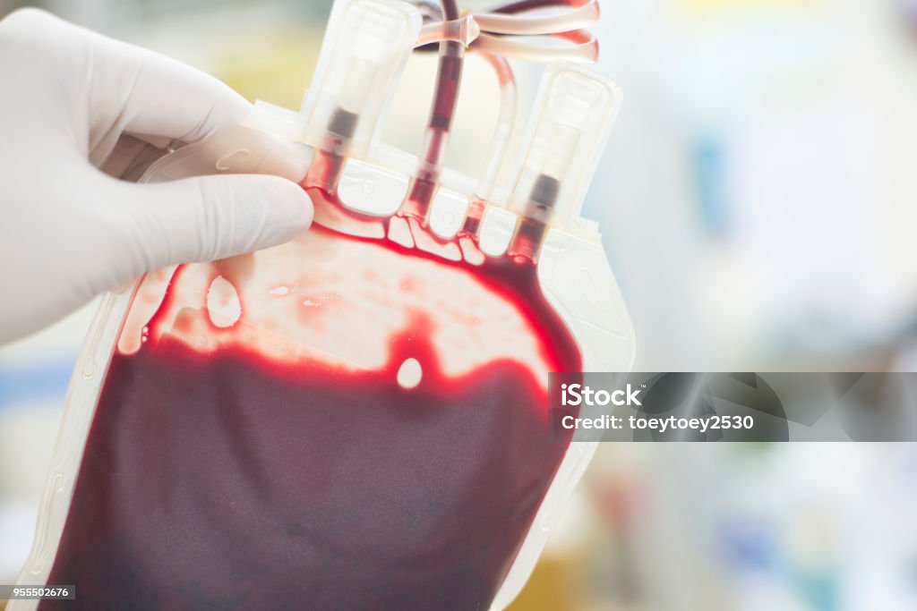 close up blood bag in laboratory medical concept. Blood Donation Stock Photo
