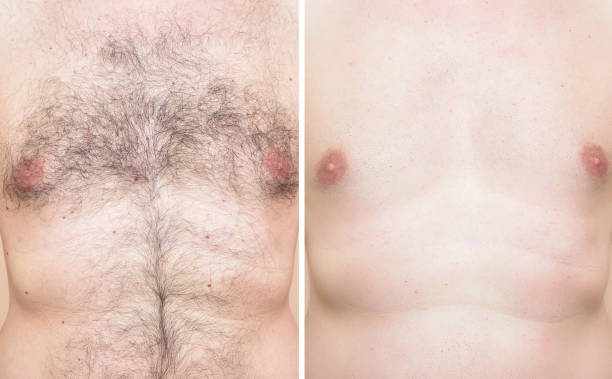 Chest of a man before and after trimming chest hair Chest of a man before and after cutting chest hair with trimmer man muscular chest stock pictures, royalty-free photos & images
