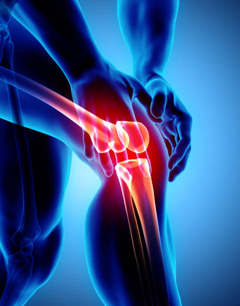 istock Knee painful - skeleton x-ray. 956015414