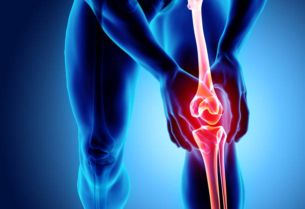 무릎 통증을-스켈레톤 x선. - osteoarthritis doctor medicine healthcare and medicine 뉴스 사진 이미지