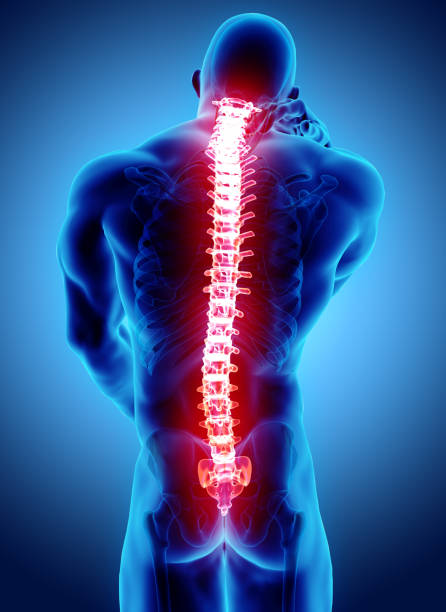 istock 3D Illustration of sacral and cervical painful. 956015590