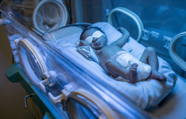 lindo bebê recém-nascido de latino-americanos na incubadora recebendo tratamento para icterícia - yellowing - fotografias e filmes do acervo
