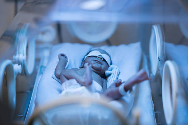istock Newborn baby in incubator getting treated for jaundice 956193246