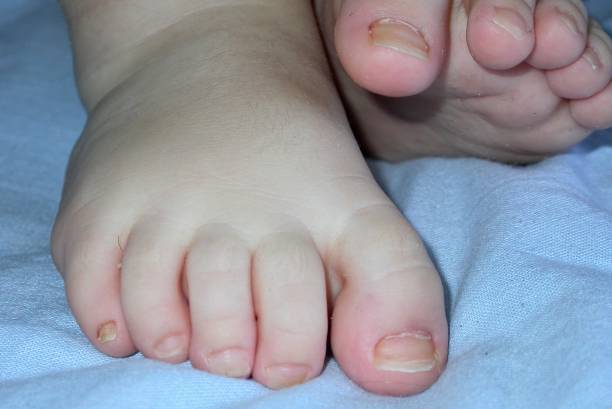 istock Feet of the baby 956307232