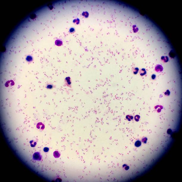 Malaria parasites seen through a microscope Ringforms of Plasmodium falciparum stained with Giemsa malaria blood sample stock pictures, royalty-free photos & images