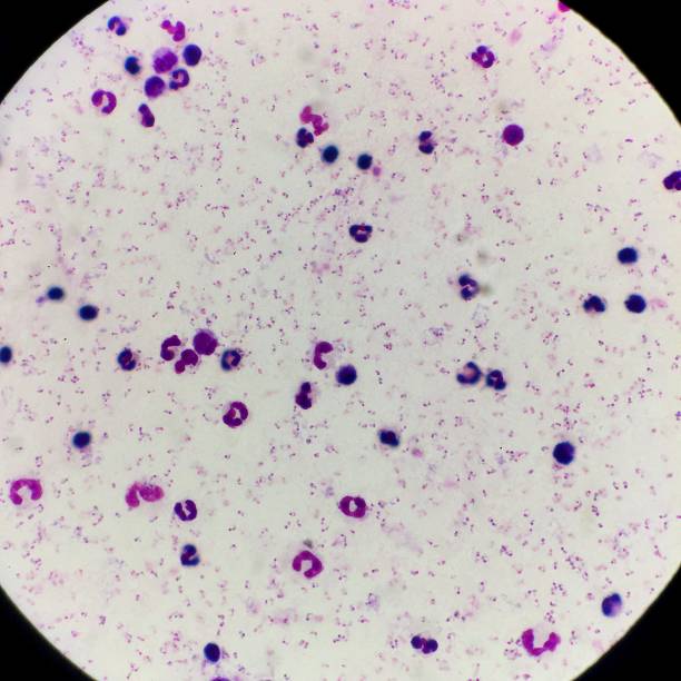 Исследования эякулята (спермы), секрета простаты - Микроскопия нативного препара