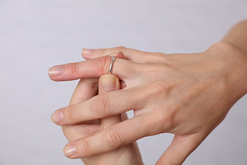 Swollen Hands. Woman traing to remove stuck ring off a swollen finger