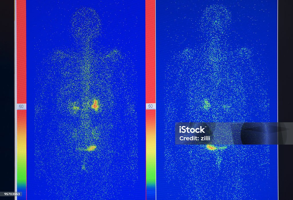 X-선 영상 - 로열티 프리 감마 스캔 스톡 사진