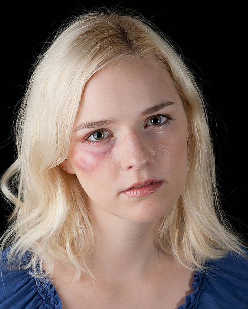 istock Victim of domestic abuse 95712478