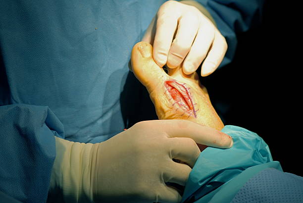 bunion chirurgie post korrektur - podiatrist orthopedic surgeon podiatry surgical equipment stock-fotos und bilder